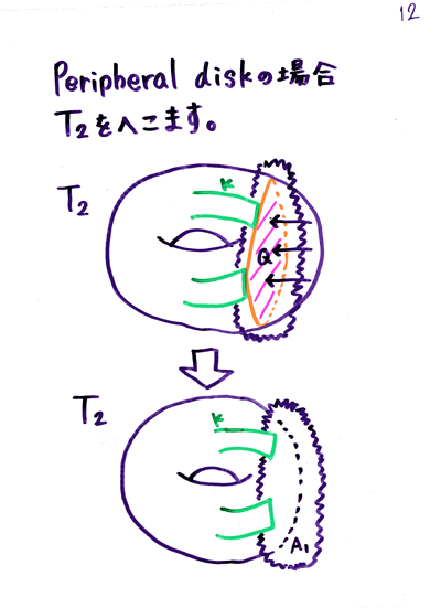 H.H.�P�Q����